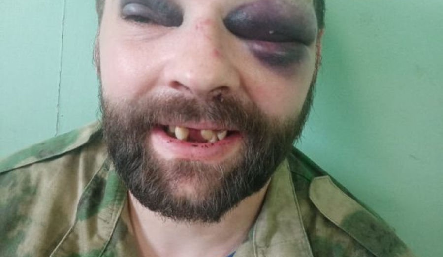 Охраняли клуб до смерти.